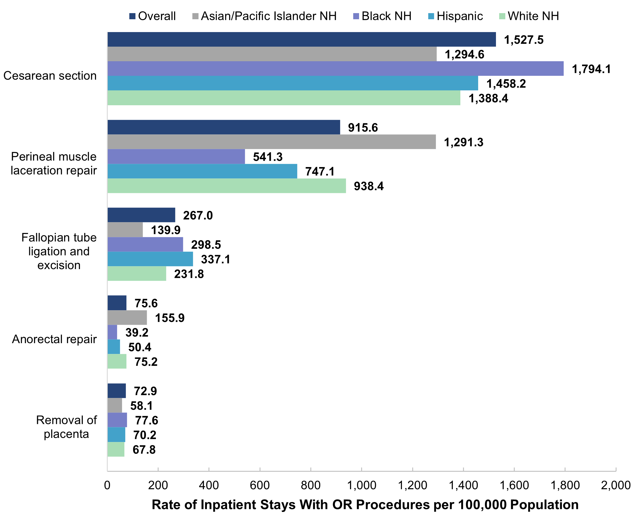 Bar chart showing the rate per 100,000 population of maternal stays with the five most common 
					operating room (OR) procedures by patient race and ethnicity (Asian/Pacific Islander [API] non-Hispanic 
					[NH], Black NH, Hispanic, White NH) in 2019. Cesarean section: overall (1,527.5), API NH (1,294.6), 
					Black NH (1,794.1), Hispanic (1,458.2), White NH (1,388.4). Perineal muscle laceration repair: overall 
					(915.6), API NH (1,291.3), Black NH (541.3), Hispanic (747.1), White NH (938.4). Fallopian tube ligation 
					and excision: overall (267.0), API NH (139.9), Black NH (298.5), Hispanic (337.1), White NH (231.8). 
					Anorectal repair: overall (75.6), API NH (155.9), Black NH (39.2), Hispanic (50.4), White NH (75.2). 
					Removal of placenta: overall (72.9), API NH (58.1), Black NH (77.6), Hispanic (70.2), White NH (67.8).